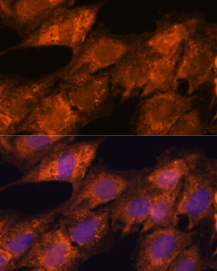 Anti-IPO4 Antibody (CAB15600)