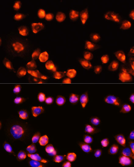 Anti-MLKL Antibody (CAB11458)