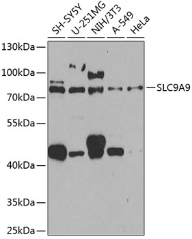 Anti-SLC9A9 Polyclonal Antibody (CAB8323)