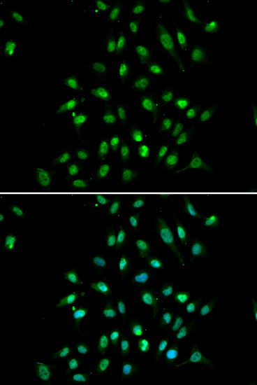 Anti-CXXC1 Antibody (CAB5814)