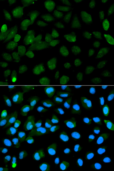 Anti-PML Antibody [KO Validated] (CAB1184)