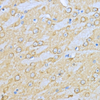 Anti-Hsp90 alpha Antibody (CAB12448)