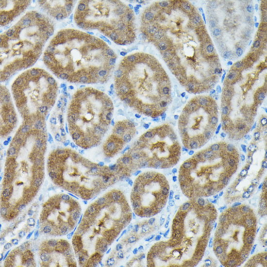 Anti-C9orf72 Antibody (CAB15970)