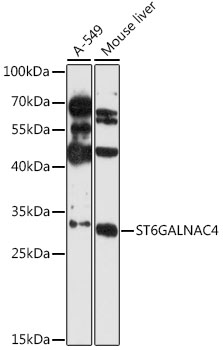 Anti-ST6GALNAC4 Antibody (CAB12880)