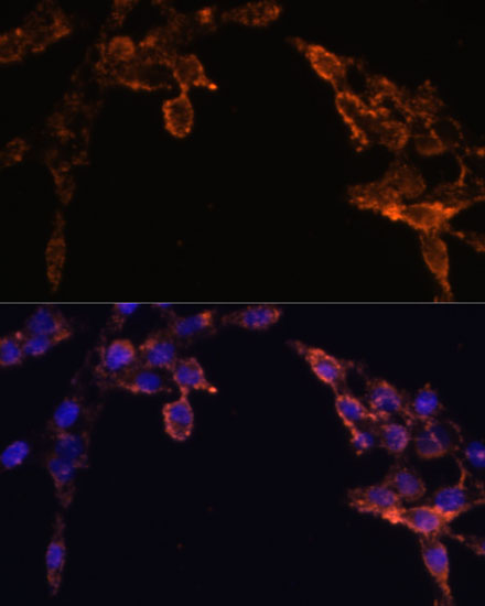 Anti-POR Polyclonal Antibody [KO Validated] (CAB8142)