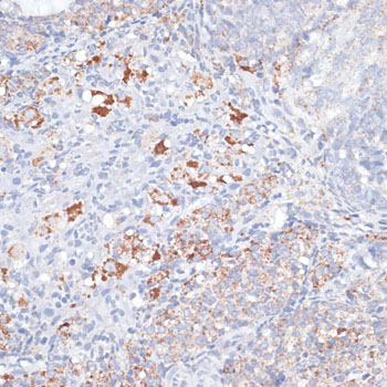 Anti-SMPD1 / ASM Antibody (CAB6743)