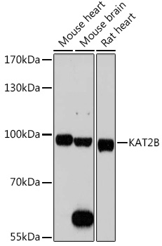 Anti-KAT2B Antibody (CAB0066)