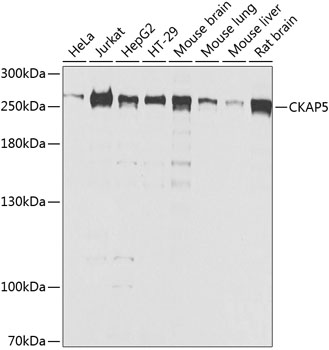 Anti-CKAP5 Polyclonal Antibody (CAB8532)