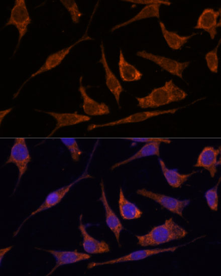 Anti-RPE Antibody (CAB14778)