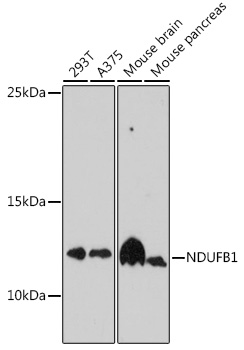 Anti-NDUFB1 Antibody (CAB16925)