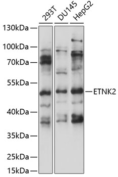 Anti-ETNK2 Antibody (CAB14628)