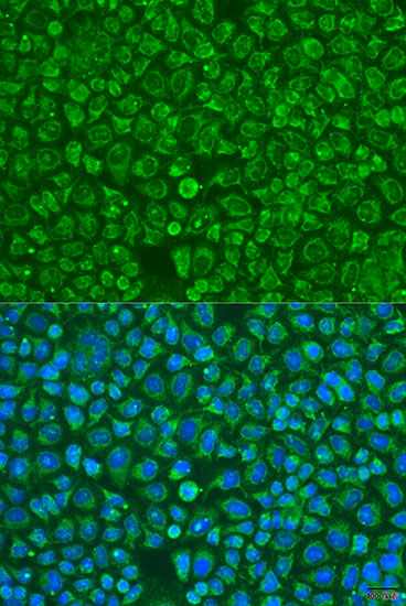 Anti-ARSF Antibody (CAB15031)