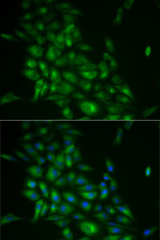 Anti-STMN1 Antibody (CAB14018)