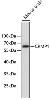 Anti-CRMP1 Antibody (CAB2705)
