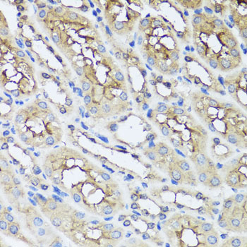 Anti-AIP Polyclonal Antibody (CAB9852)