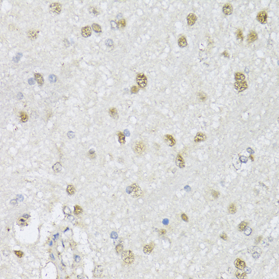 Anti-CMAS Antibody (CAB13752)