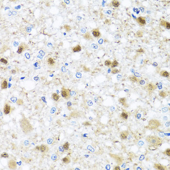 Anti-ZBTB17 Polyclonal Antibody (CAB8463)