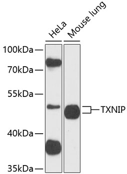 Anti-TXNIP Polyclonal Antibody (CAB9342)