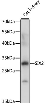 Anti-SIX2 Polyclonal Antibody (CAB8727)