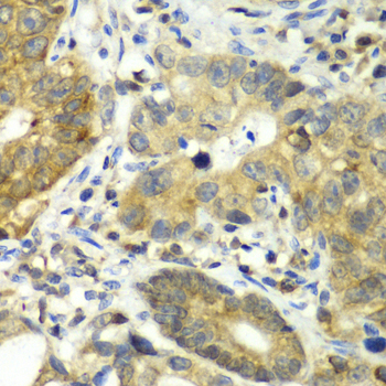 Anti-DPP3 Antibody (CAB13390)