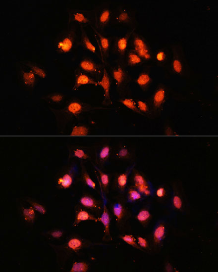 Anti-PHLPP1 Polyclonal Antibody (CAB9542)