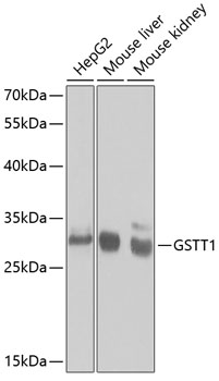 Anti-GSTT1 Antibody (CAB1287)