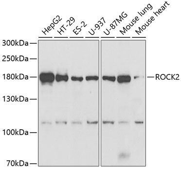 Anti-ROCK2 Antibody (CAB5698)