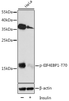 Anti-Phospho-EIF4EBP1-T70 Antibody (CABP0031)