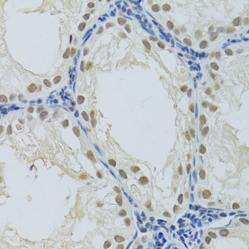 Anti-DDB1 Antibody (CAB2896)