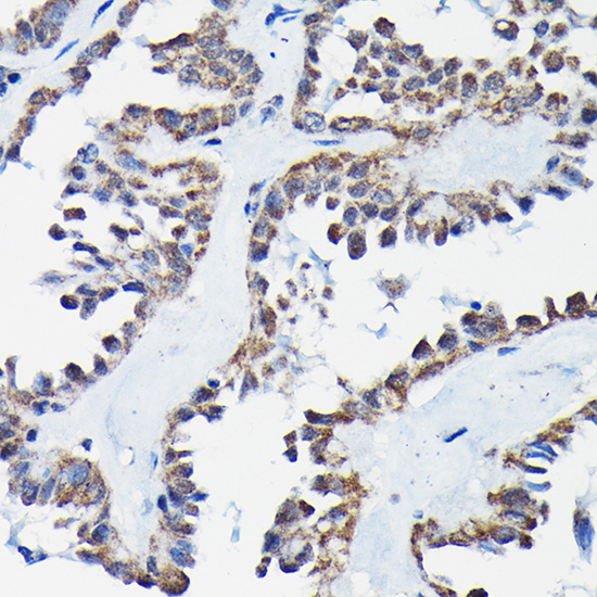 Anti-RGS14 Polyclonal Antibody (CAB9962)