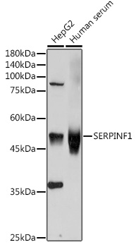 Anti-SERPINF1 Antibody (CAB11782)