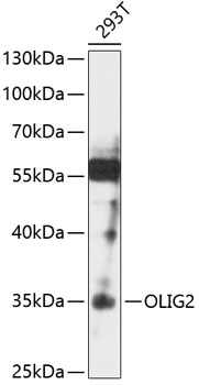 Anti-OLIG2 Antibody (CAB12814)