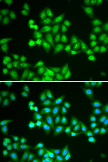 Anti-CHD2 Antibody (CAB13476)