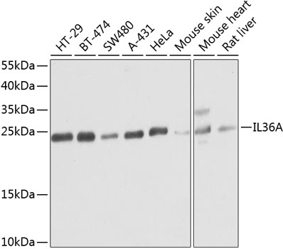 Anti-IL36A Polyclonal Antibody (CAB8207)