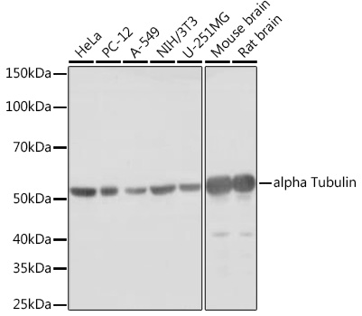 Anti-Tubulin alpha 1b Antibody