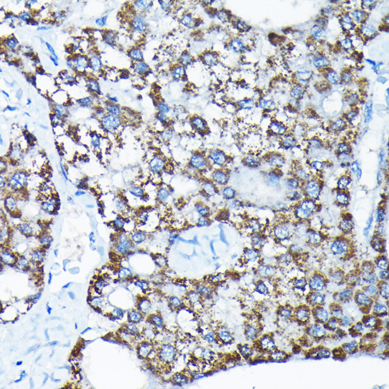 Anti-ETFA Antibody (CAB7670)