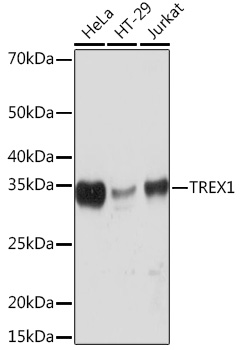 Anti-TREX1 Antibody (CAB3819)