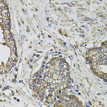 Anti-PTHLH Antibody (CAB12492)