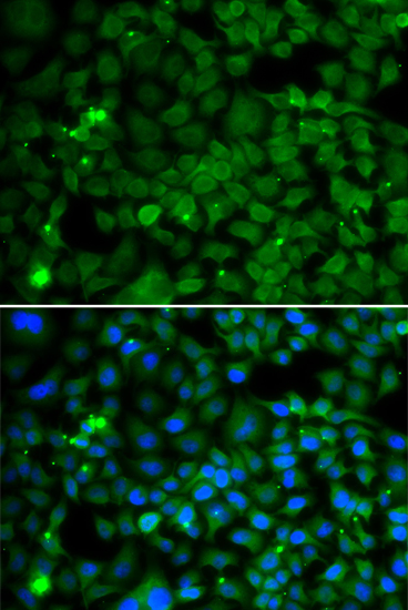 Anti-SMYD4 Antibody (CAB2337)