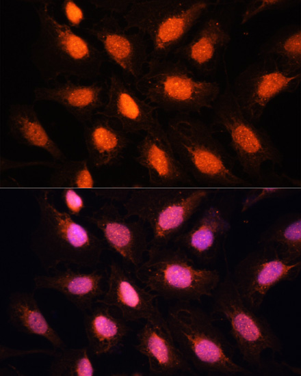 Anti-TERF2IP Polyclonal Antibody (CAB7981)