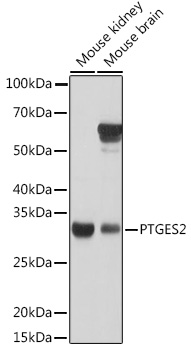 Anti-PTGES2 Antibody (CAB7137)