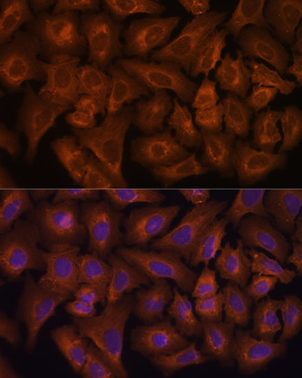 Anti-NEXN Antibody (CAB13136)