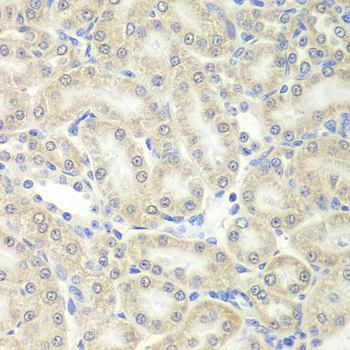 Anti-PRDX5 Antibody (CAB6329)