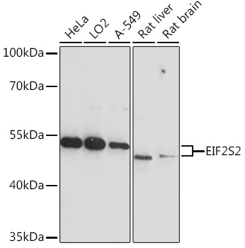 Anti-EIF2S2 Antibody (CAB17040)