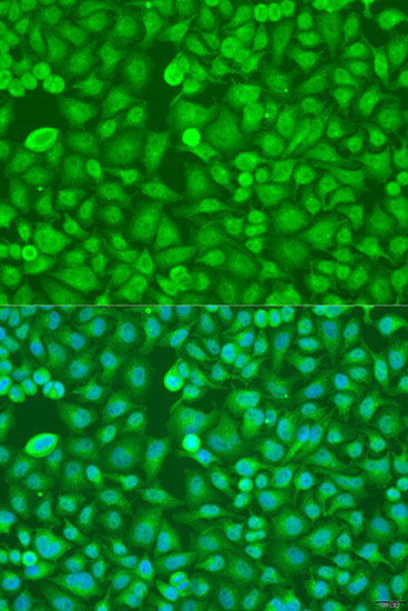 Anti-TIA1 Antibody (CAB12517)