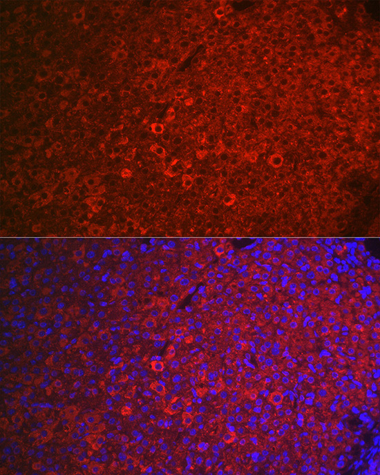 Anti-FSHR Antibody (CAB1480)