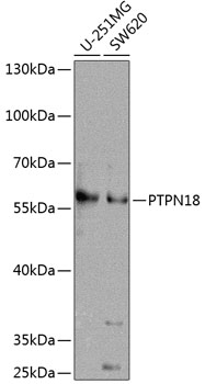 Anti-PTPN18 Polyclonal Antibody (CAB8487)