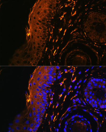 Anti-TGM1 Antibody (CAB7343)