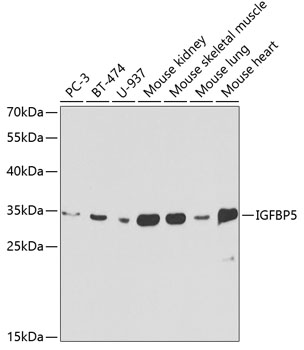 Anti-IGFBP5 Antibody (CAB1720)