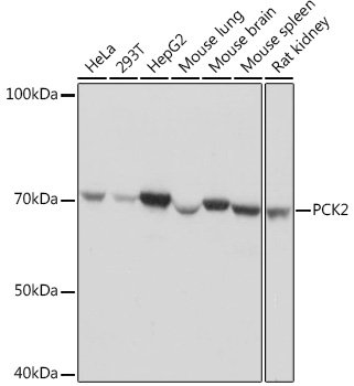 Anti-PCK2 Antibody (CAB4466)